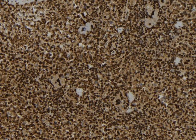 IST1 Antibody in Immunohistochemistry (Paraffin) (IHC (P))