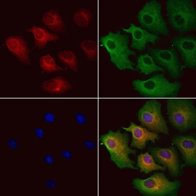 MCD Antibody in Immunocytochemistry (ICC/IF)