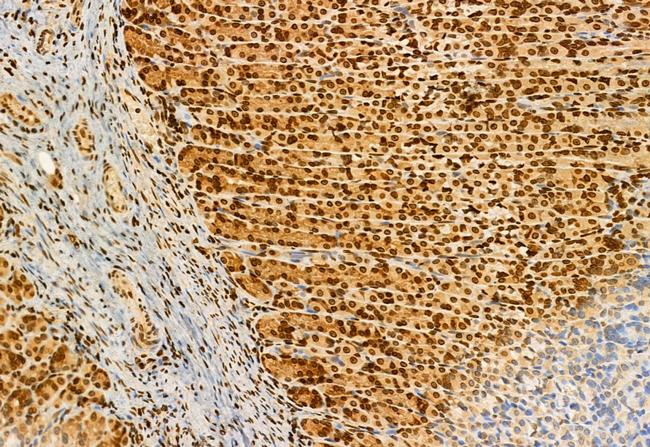 AP3B1 Antibody in Immunohistochemistry (Paraffin) (IHC (P))