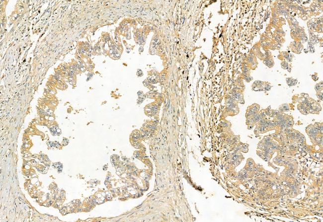 CISD2 Antibody in Immunohistochemistry (Paraffin) (IHC (P))