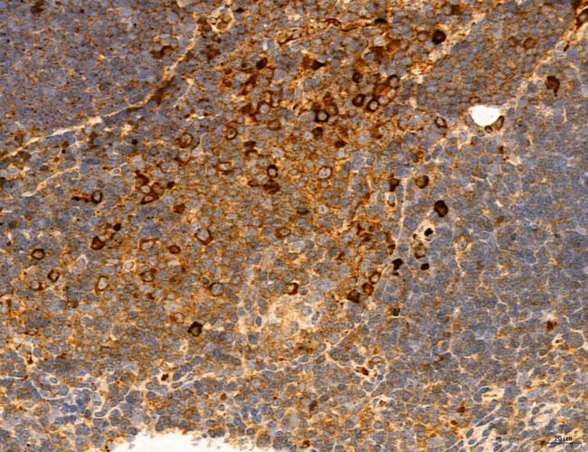 PPAT Antibody in Immunohistochemistry (Paraffin) (IHC (P))