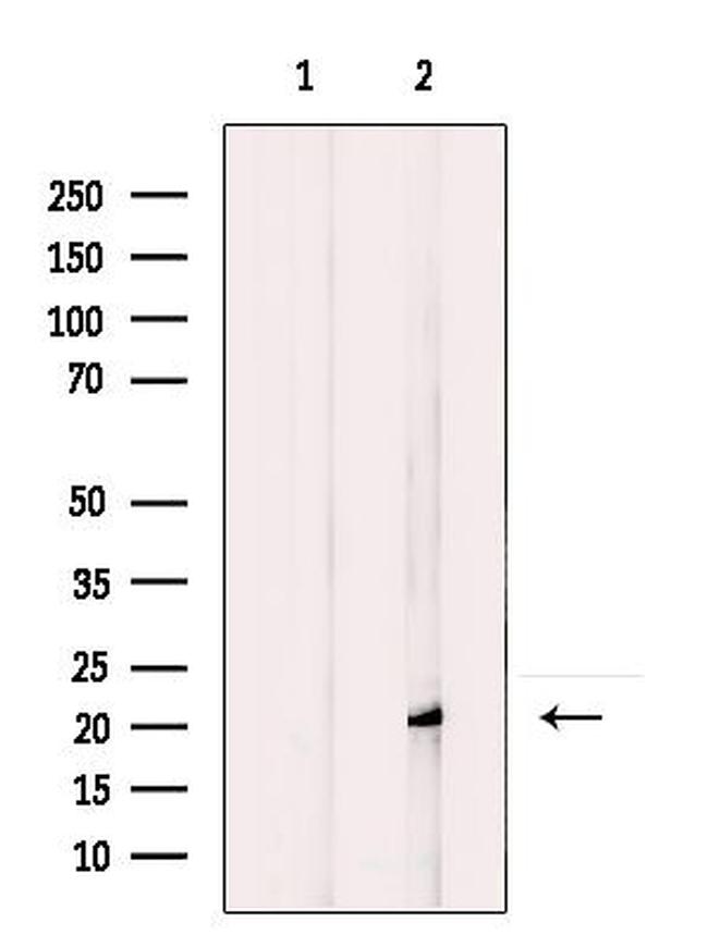 ARL3 Antibody in Western Blot (WB)