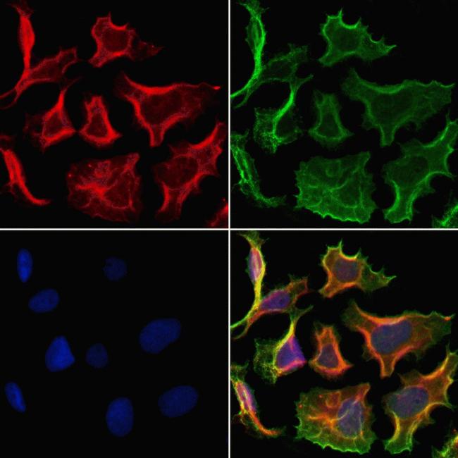 CHMP2A Antibody in Immunocytochemistry (ICC/IF)