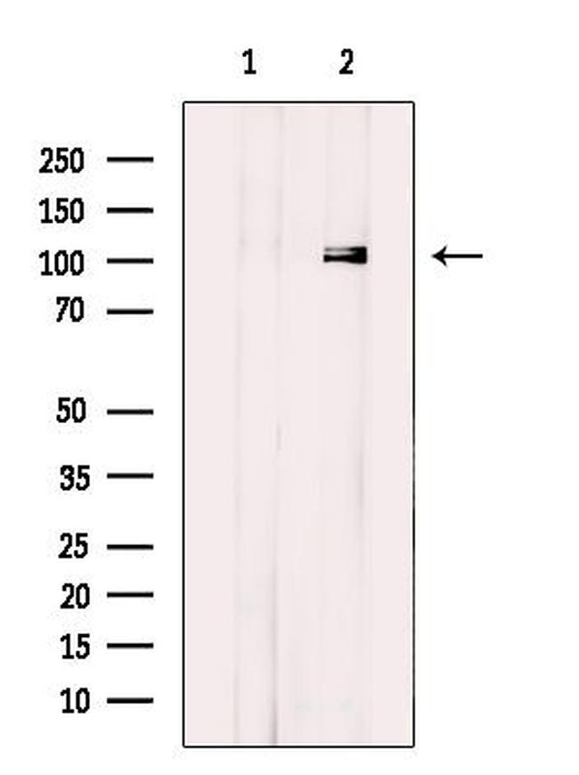 ELAC2 Antibody in Western Blot (WB)