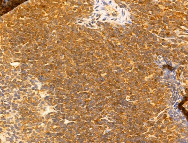 SYNPO2 Antibody in Immunohistochemistry (Paraffin) (IHC (P))