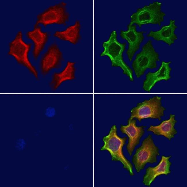 STX11 Antibody in Immunocytochemistry (ICC/IF)