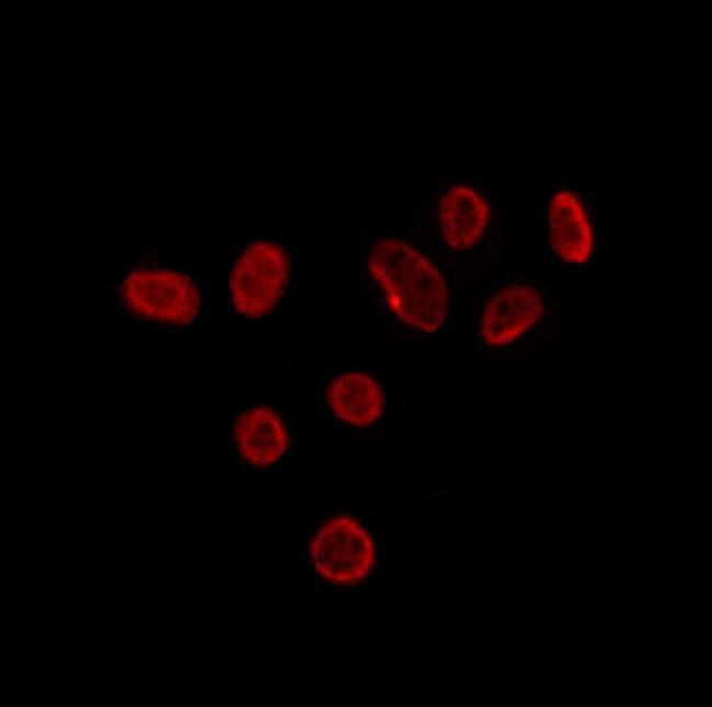 TIA-1 Antibody in Immunocytochemistry (ICC/IF)