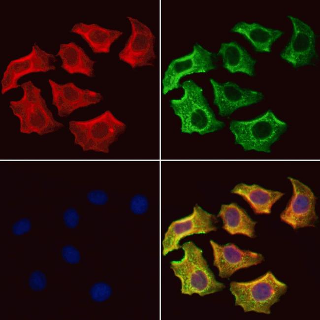 UQCRB Antibody in Immunocytochemistry (ICC/IF)