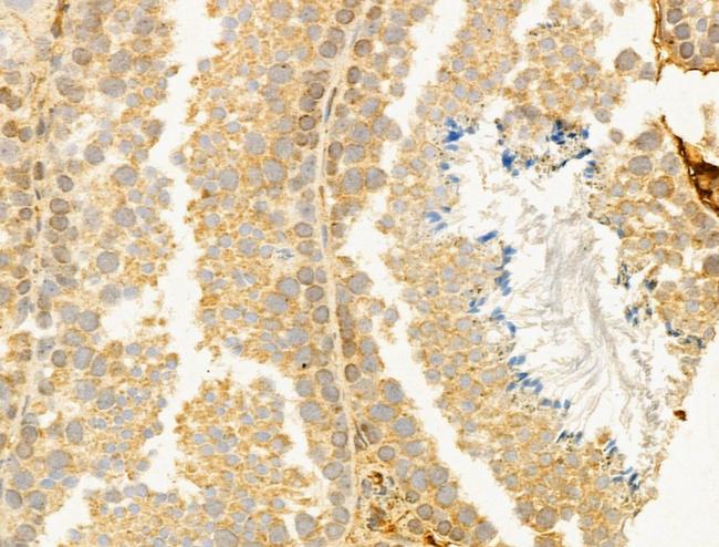 CYLD Antibody in Immunohistochemistry (Paraffin) (IHC (P))