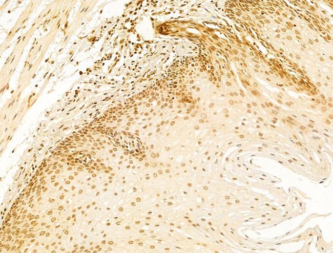 OIP5 Antibody in Immunohistochemistry (Paraffin) (IHC (P))