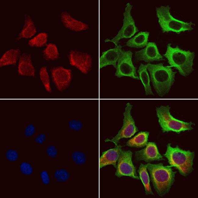 ACADVL Antibody in Immunocytochemistry (ICC/IF)