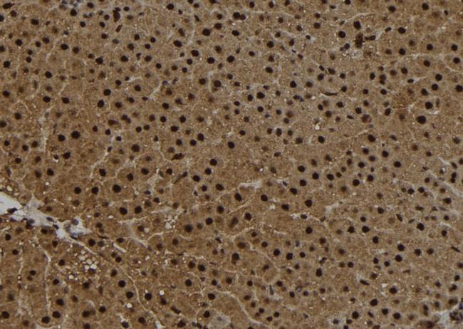 Centrin 2 Antibody in Immunohistochemistry (Paraffin) (IHC (P))