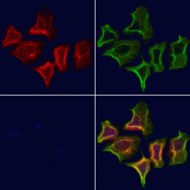 FECH Antibody in Immunocytochemistry (ICC/IF)