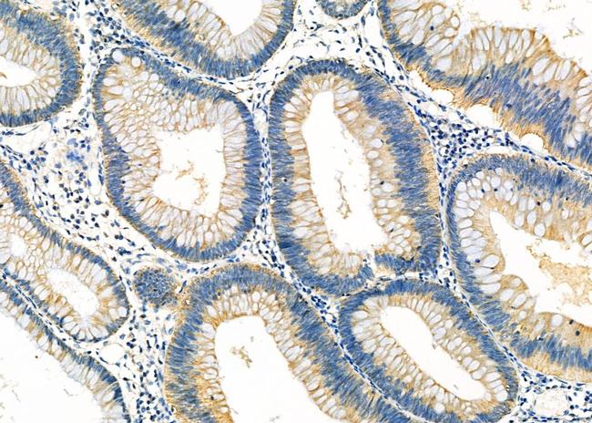 IVD Antibody in Immunohistochemistry (Paraffin) (IHC (P))