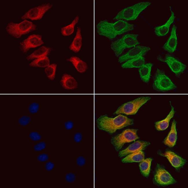 MAD2L2 Antibody in Immunocytochemistry (ICC/IF)