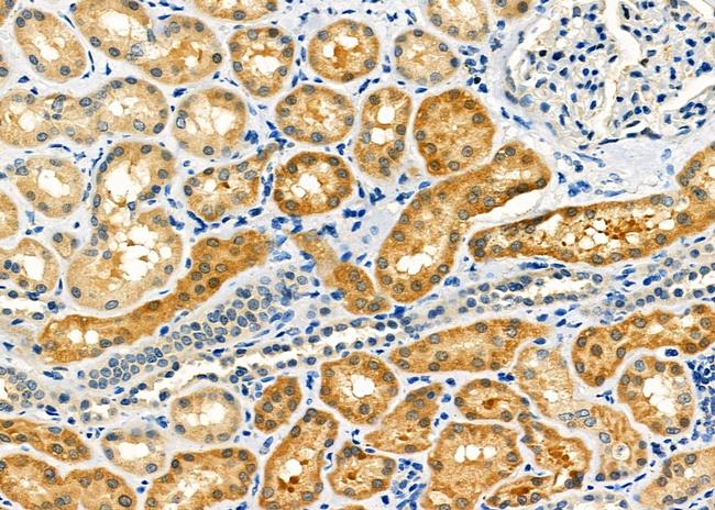 MLXIP Antibody in Immunohistochemistry (Paraffin) (IHC (P))