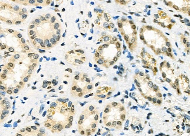 SSNA1 Antibody in Immunohistochemistry (Paraffin) (IHC (P))