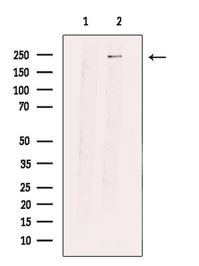 PRP8 Antibody in Western Blot (WB)