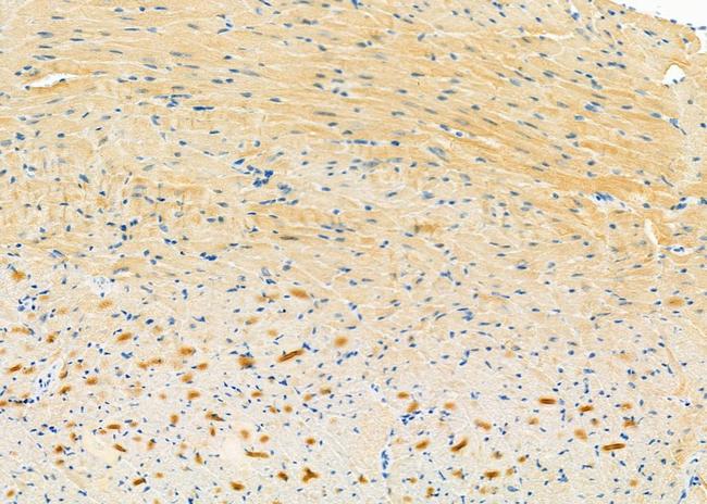 SH2D1B Antibody in Immunohistochemistry (Paraffin) (IHC (P))