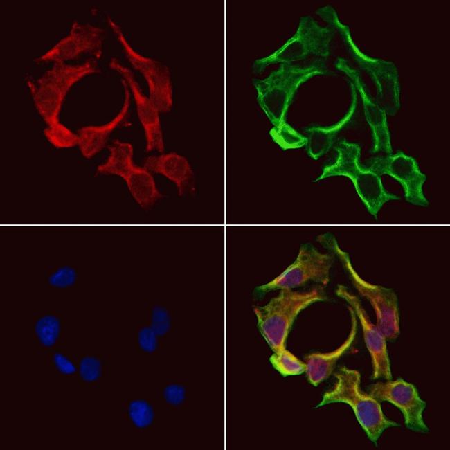 SLC38A3 Antibody in Immunocytochemistry (ICC/IF)