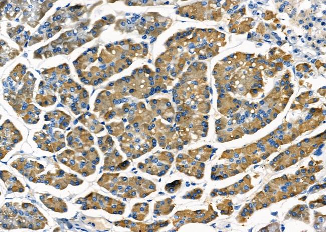 STT3B Antibody in Immunohistochemistry (Paraffin) (IHC (P))