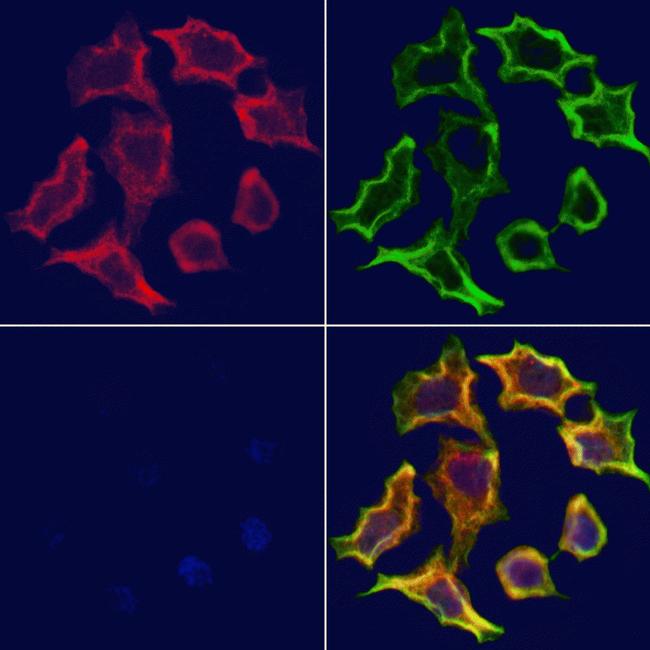 STX16 Antibody in Immunocytochemistry (ICC/IF)