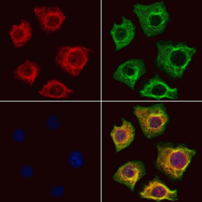 TRBP Antibody in Immunocytochemistry (ICC/IF)