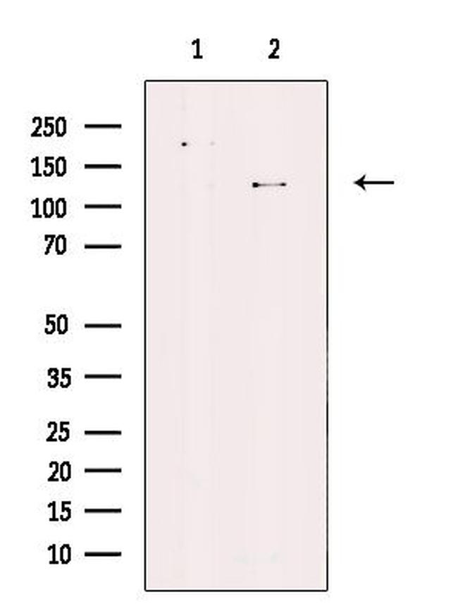 ATP8A1 Antibody in Western Blot (WB)