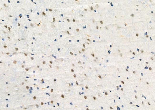 E2F3 Antibody in Immunohistochemistry (Paraffin) (IHC (P))