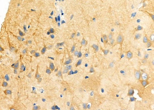 MAP1B Antibody in Immunohistochemistry (Paraffin) (IHC (P))