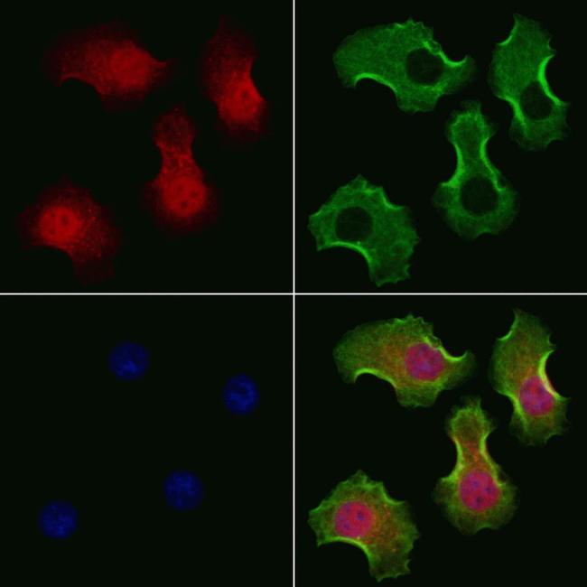 PHF17 Antibody in Immunocytochemistry (ICC/IF)