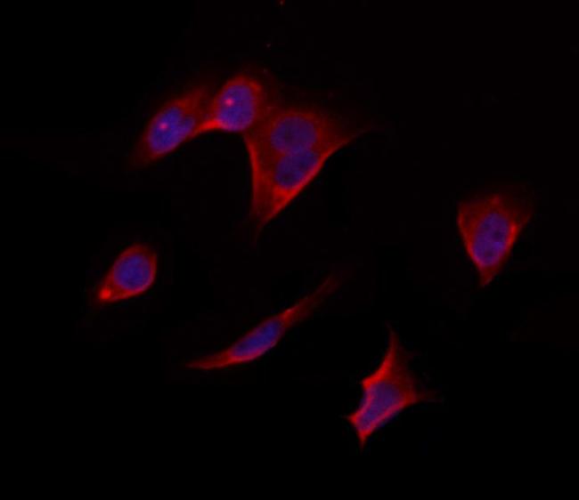 RPS14 Antibody in Immunocytochemistry (ICC/IF)