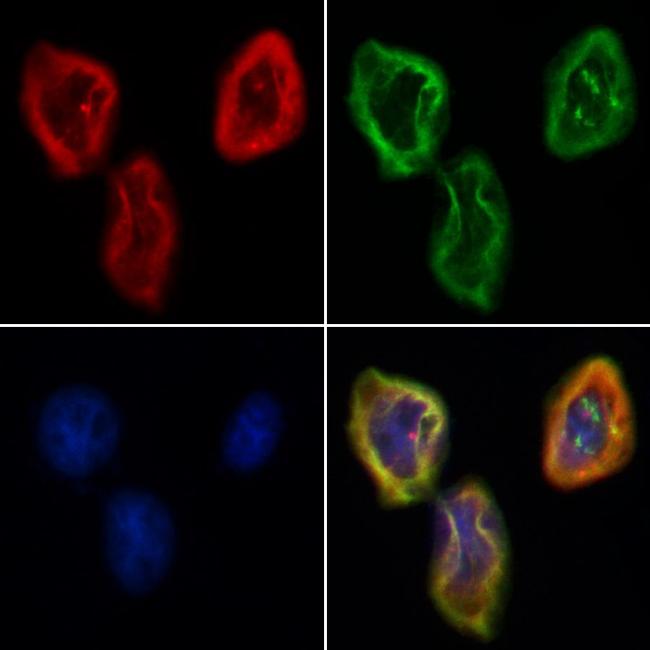 TCTN2 Antibody in Immunocytochemistry (ICC/IF)