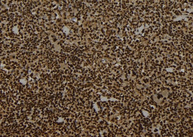 WRAP53 Antibody in Immunohistochemistry (Paraffin) (IHC (P))