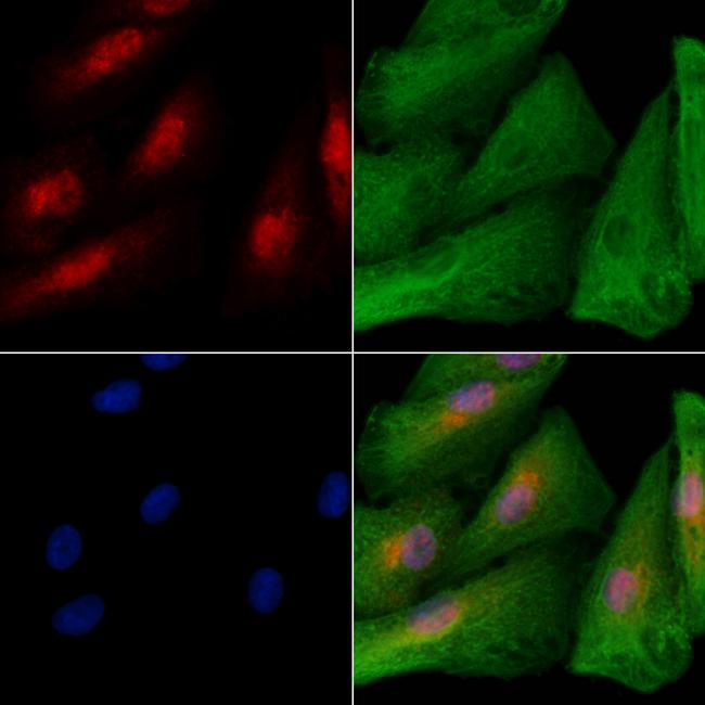 KLF12 Antibody in Immunocytochemistry (ICC/IF)