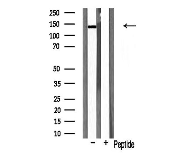 HGK Antibody in Western Blot (WB)