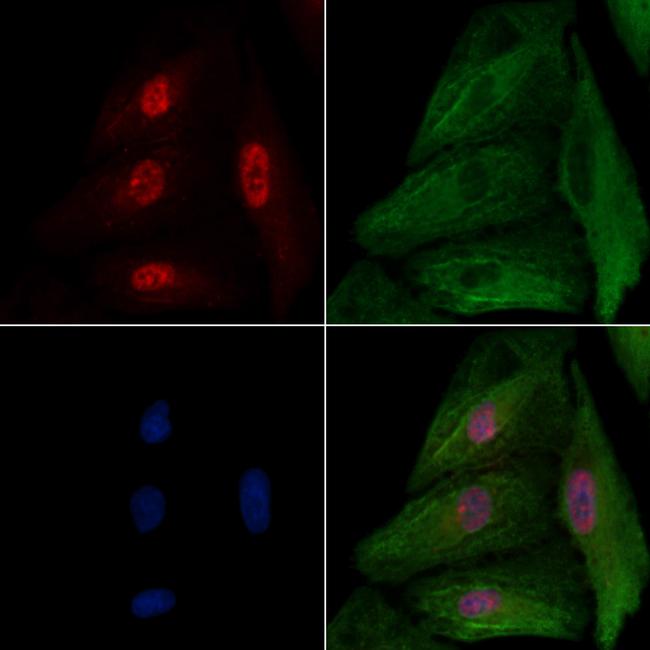 NR2F6 Antibody in Immunocytochemistry (ICC/IF)