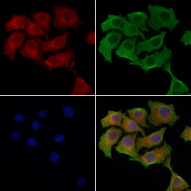 PRKAR2A Antibody in Immunocytochemistry (ICC/IF)