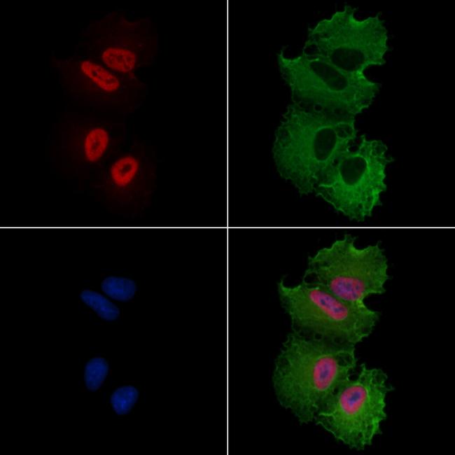 ATF7 Antibody in Immunocytochemistry (ICC/IF)