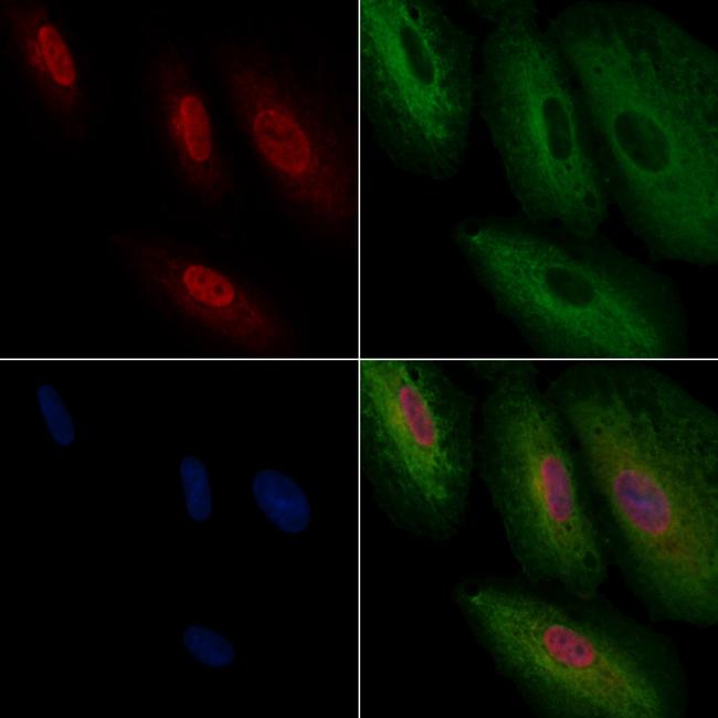 TEAD1 Antibody in Immunocytochemistry (ICC/IF)