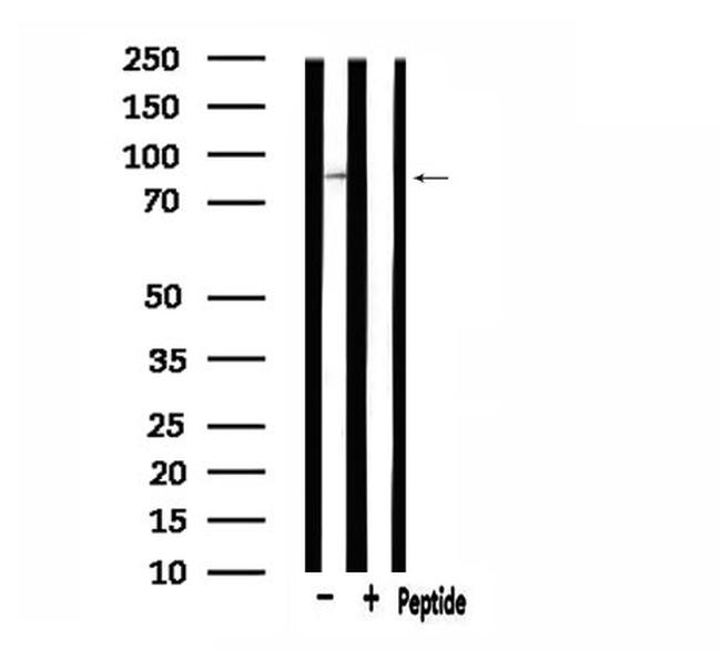 SOX6 Antibody in Western Blot (WB)