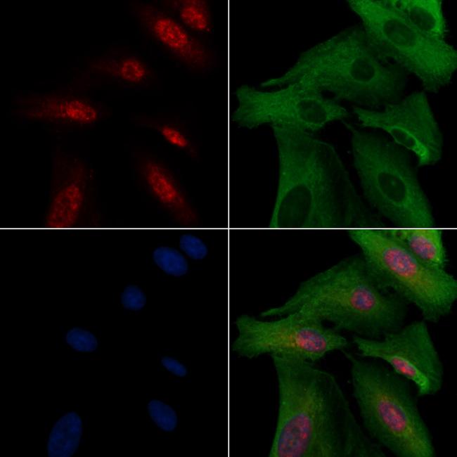 MEOX2 Antibody in Immunocytochemistry (ICC/IF)