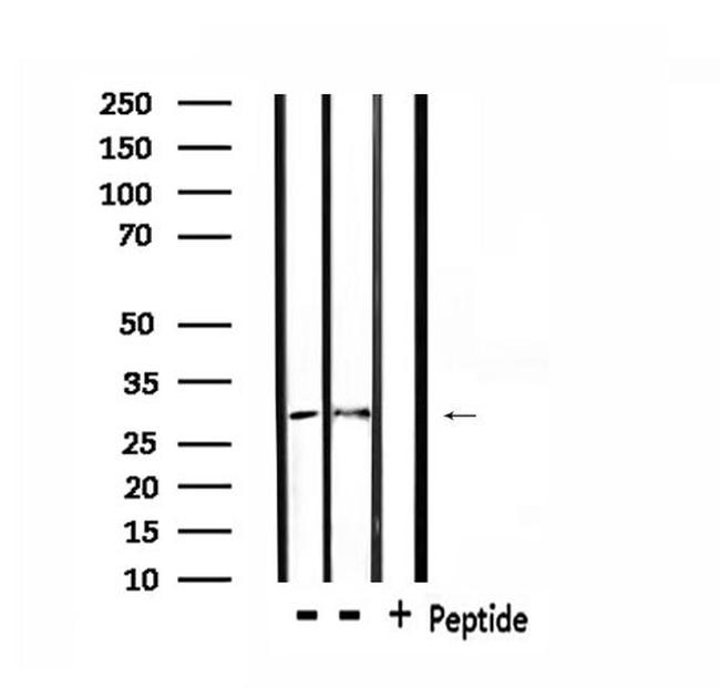 CD137 Antibody in Western Blot (WB)