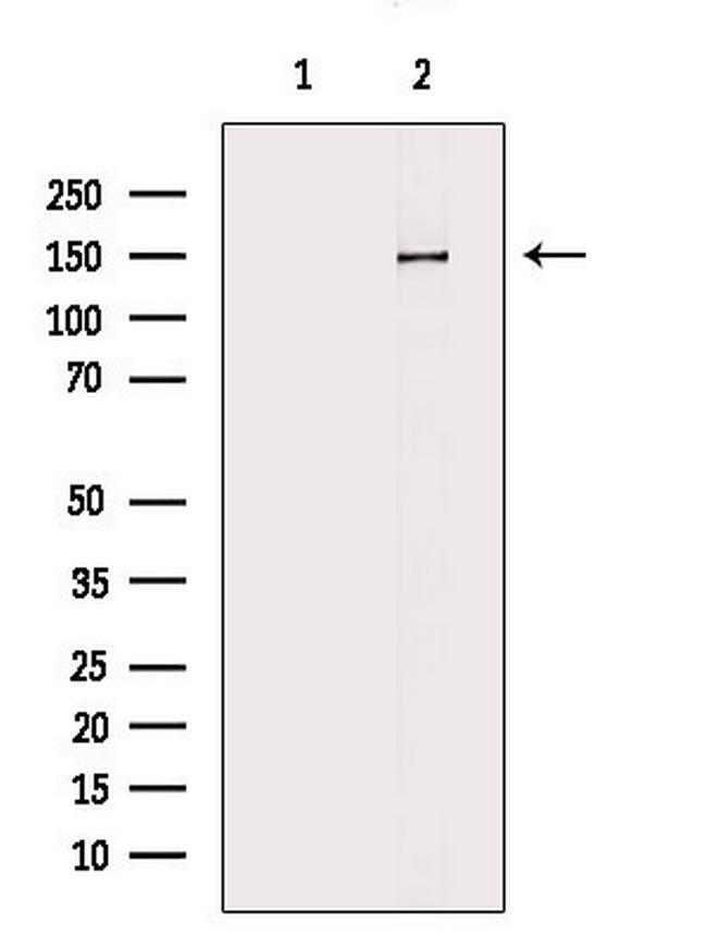 CHAF1A Antibody in Western Blot (WB)