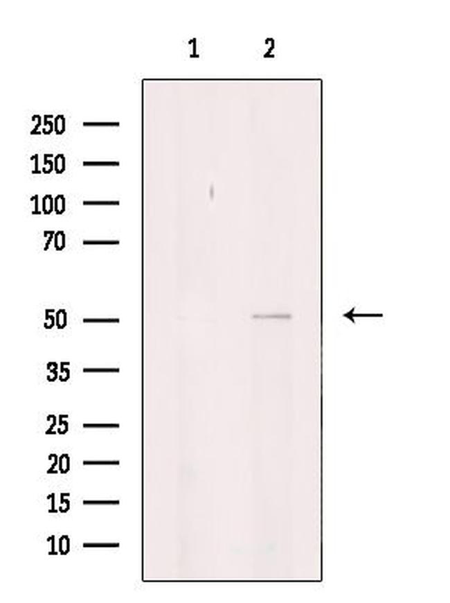 ITPK1 Antibody in Western Blot (WB)