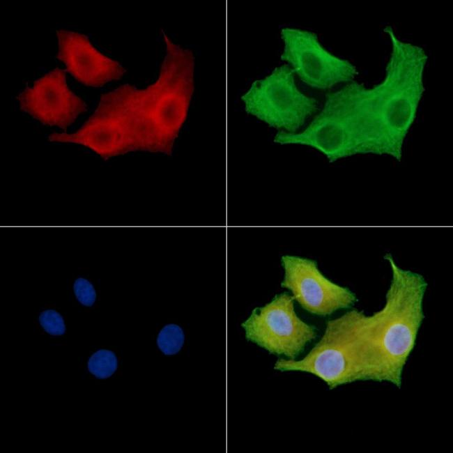 ADCK5 Antibody in Immunocytochemistry (ICC/IF)