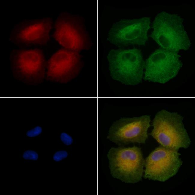 SLC22A18 Antibody in Immunocytochemistry (ICC/IF)