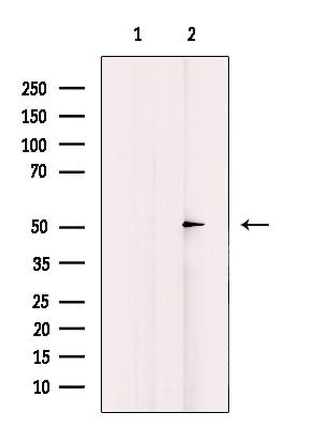 AZI2 Antibody in Western Blot (WB)