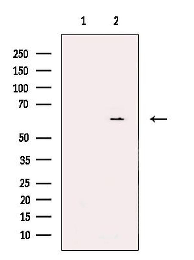 CYP26C1 Antibody in Western Blot (WB)