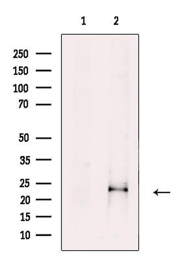 FGF18 Antibody in Western Blot (WB)